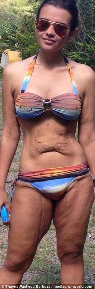 Η απίστευτη μεταμόρφωση μίας Βραζιλιάνας που έγινε viral -Εχασε 80 κιλά, από 140 πήγε 60! (εικόνες)