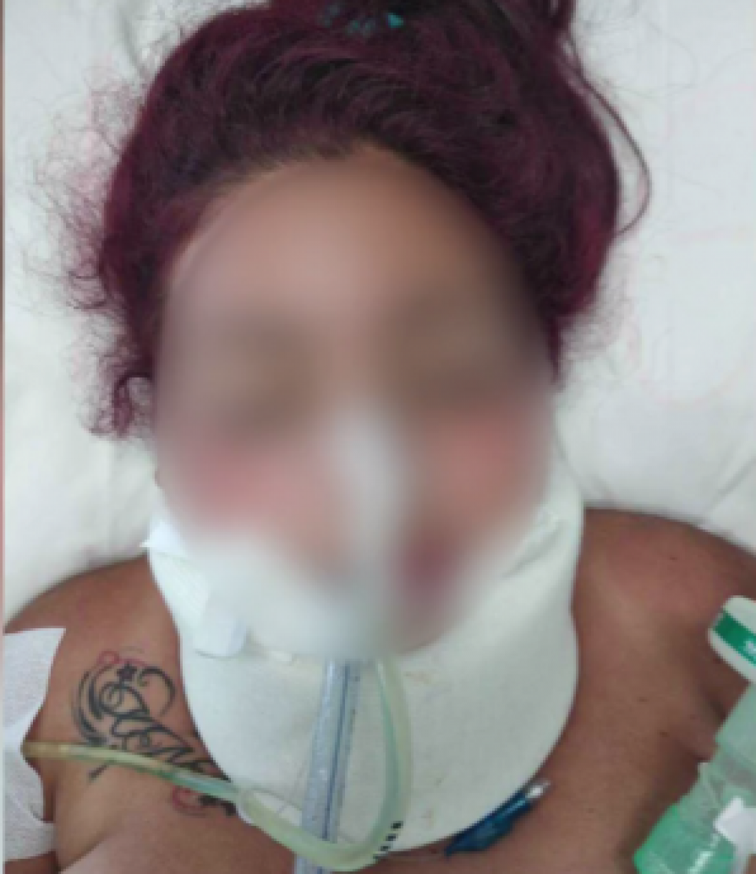 H άτυχη γυναίκα μέσα στο νοσοκομείο/Φωτογραφία: Star