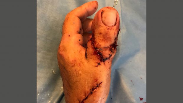 hand toe | Lamianow.gr