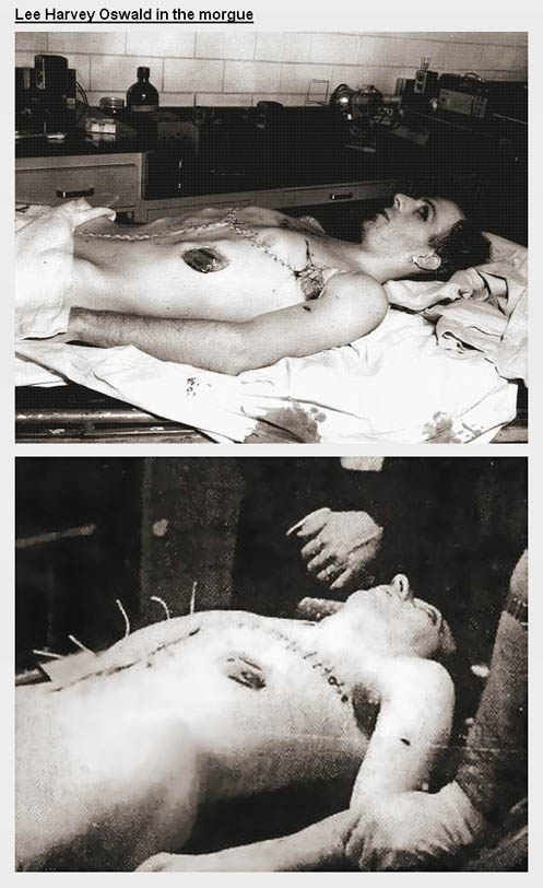 Oswald Autopsy