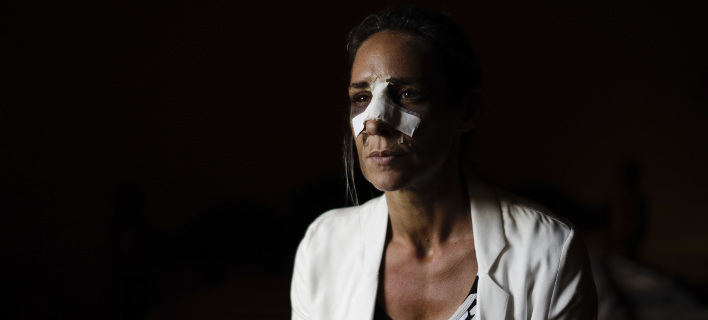 Δεν διαπιστώνεται κάποιο συγκεκριμένο προφίλ των δραστών που κακοποιούν γυναίκες, φωτογραφίες: AP images