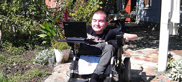 Αυτός είναι ο άντρας που θα υποβληθεί στην πρώτη μεταμόσχευση κεφαλιού [εικόνες]