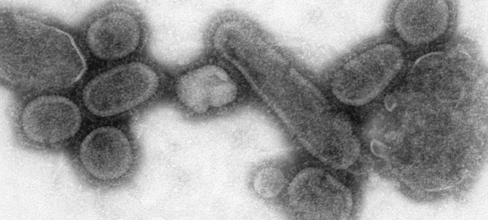 Ο ιός της ισπανικής γρίπης σκότωσε 25 εκ. ανθρώπους το 1918 