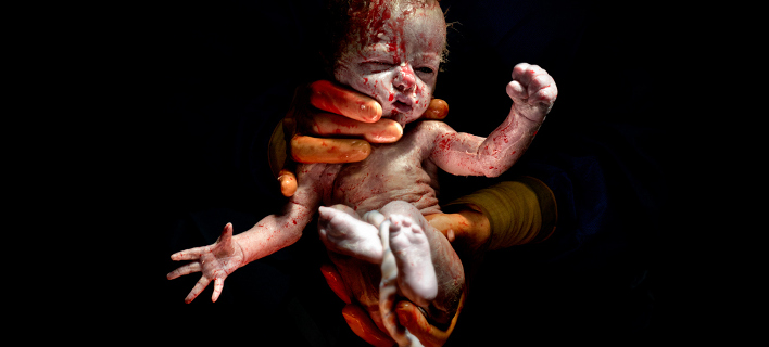 Το σοκαριστικό θαύμα της γέννησης: Καλλιτέχνης απαθανατίζει τα πρώτα δευτερόλεπτα της ζωής [εικόνες]