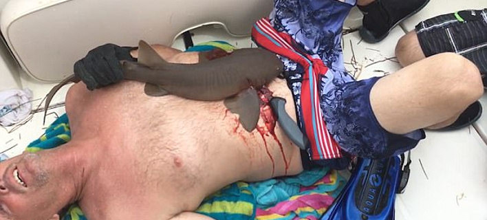 Ούτε σε θρίλερ: Καρχαρίας γαντζώνει τα σαγόνια του στην κοιλιά ενός ψαρά και αρνείται να φύγει [εικόνες & βίντεο]