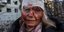 Γυναίκα στο Χάρκοβο τραυματισμένη από ρωσικό βομβαρδισμό