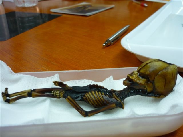 Φρίκαραν οι επιστήμονες! Βρέθηκε ανθρώπινος σκελετός «τσέπης» 15 εκ. με σπάνιες παραμορφώσεις [εικόνες] 
