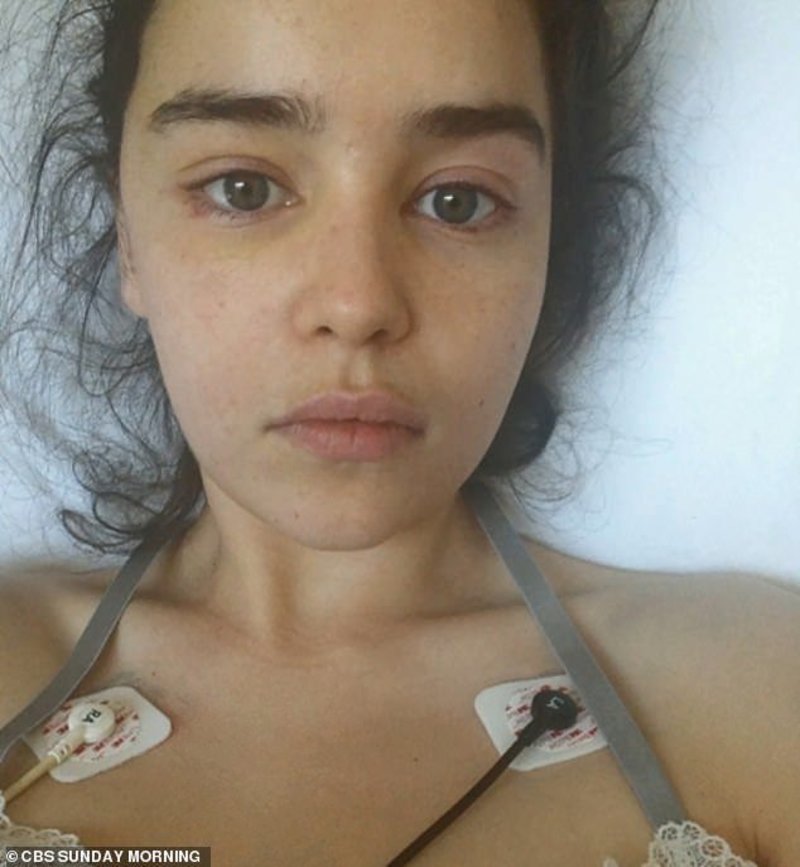 Η Εμίλια Κλαρκ ξαπλωμένη σε κρεβάτι νοσοκομείου