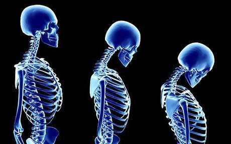 Osteostrong μπλε σκελετός