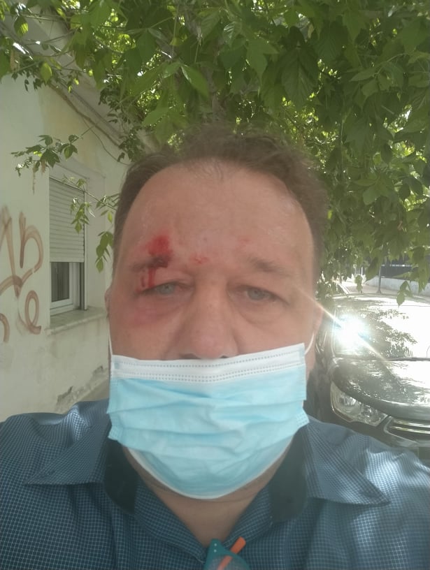 Θεσσαλία: Καταγγελία για επίθεση σε δημοσιογράφο στη Νέα Σμύρνη ...