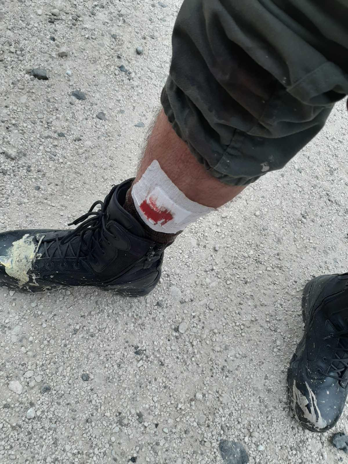 αστυνομία τραυματίας μυτιλήνη