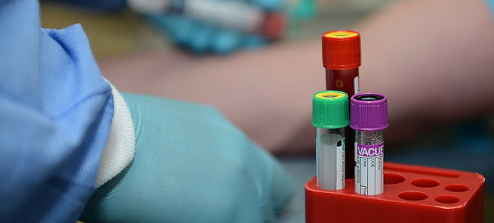 To νέο τεστ αίματος ανιχνεύει και τον καρκίνο των ωοθηκών (Φωτογραφία αρχείου: health.mil) 