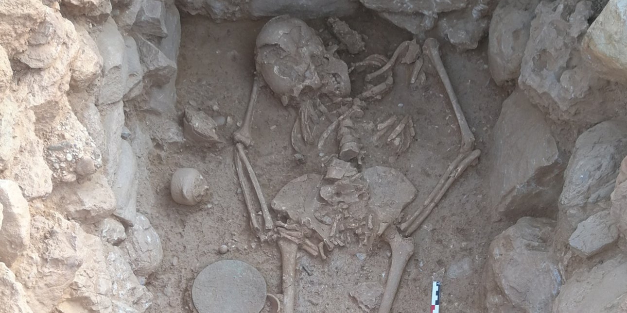 Νέα μυστικά της ανθρώπινης εξέλιξης από μεγάλη έρευνα για το αρχαίο DNA -Το παράδοξο με την σκλήρυνση κατά πλάκας