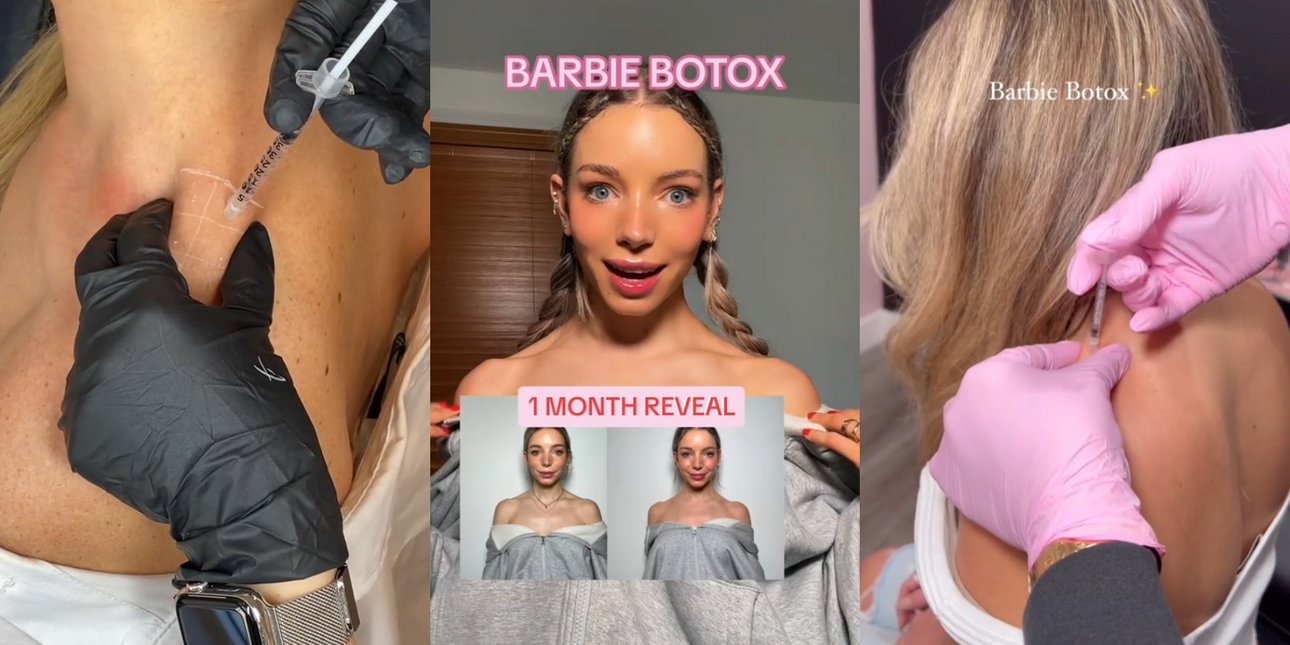 Τι είναι το «Barbie botox» που έχει γίνει trend στο TikTok -Η ...