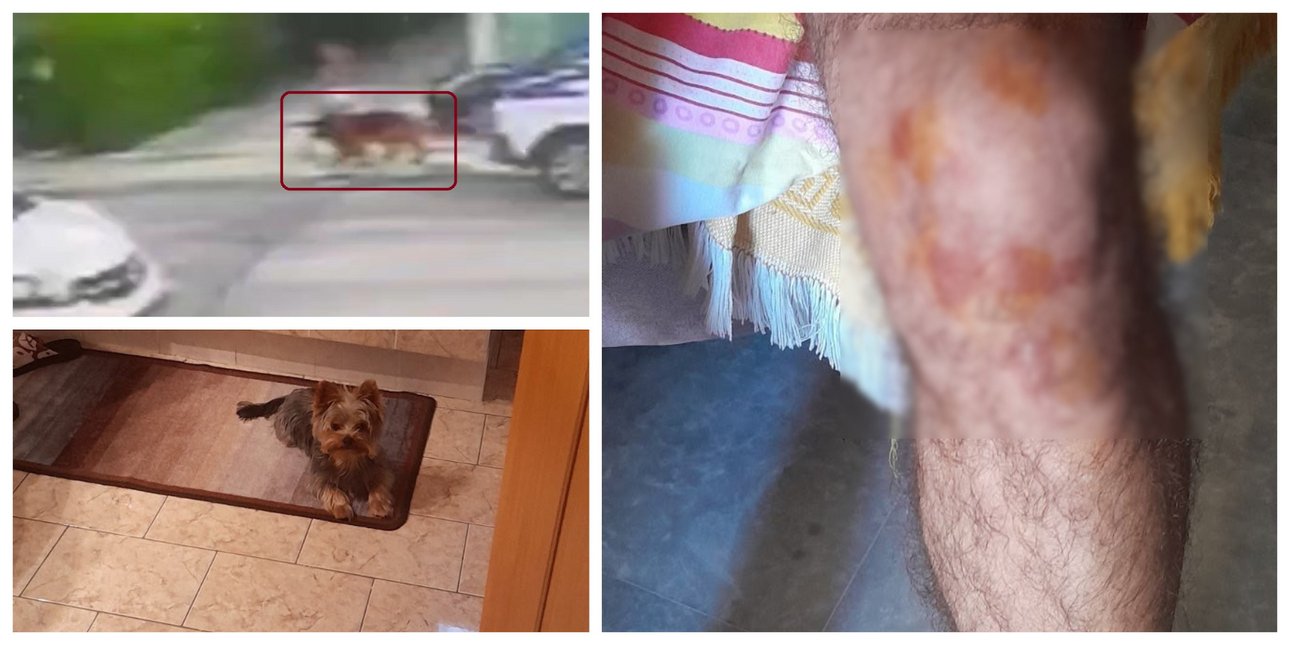 Το μικρό σκυλάκι σκότωσε το λυκόσκυλο που φαίνεται να περπατά στα Βριλήσσια και τραυμάτισε το αφεντικό του