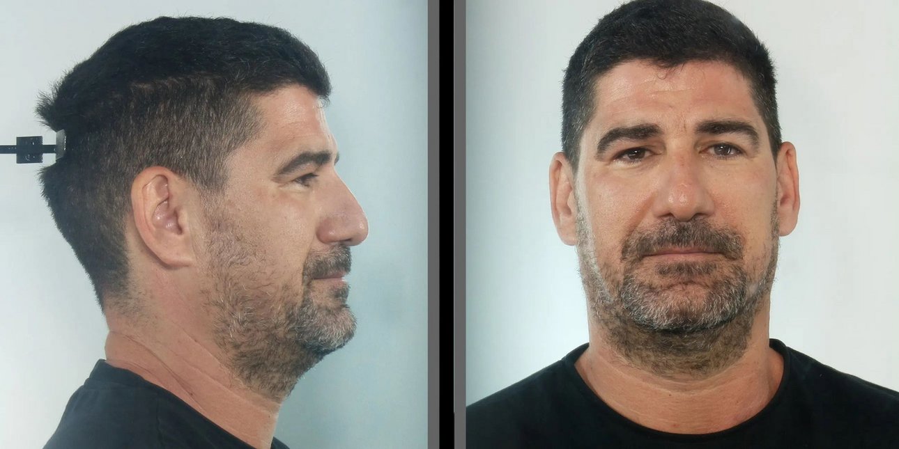 Κεφαλονιά: Στη δημοσιότητα από την ΕΛΑΣ τα στοιχεία του προπονητή που διώκεται για βιασμούς ανηλίκων αθλητριών κατ' εξακολούθηση