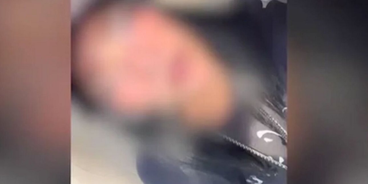«Προμηθεύτηκα την ουσία G από ένα rave party στην Αθήνα, ήθελα να πειραματιστώ», λέει η 21χρονη από την Πάρο που νοσηλεύεται στο Τζάνειο