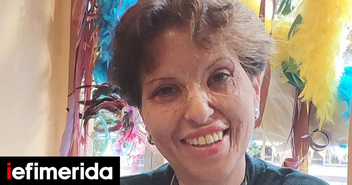 Καλλιόπη Αθανασιάδη Συγκλονίζει η θωρακοχειρουγός, 52 χρόνια μετά το