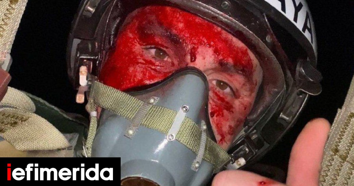 An amazing selfie taken by a Ukrainian pilot with a bloody face and his fighter on fire!