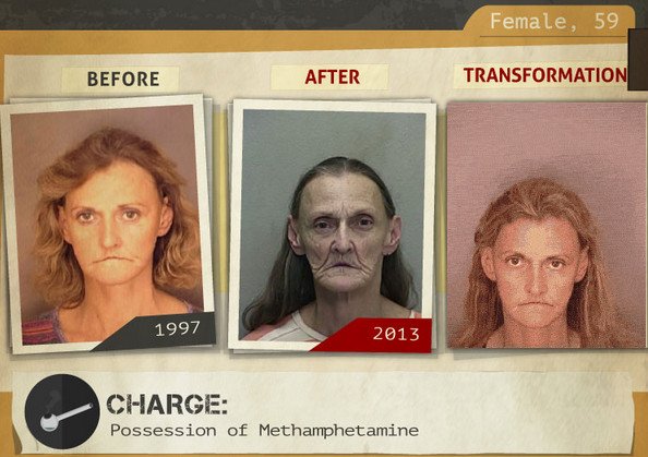 Φωτογραφίες σοκ: Καρέ-καρέ πώς αλλοιώνονται τα προσώπα των ναρκομανών -Ανθρωποι πριν και μετά τη χρήση [gif] | iefimerida.gr 19