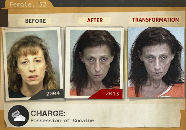 Φωτογραφίες σοκ: Καρέ-καρέ πώς αλλοιώνονται τα προσώπα των ναρκομανών -Ανθρωποι πριν και μετά τη χρήση [gif] | iefimerida.gr 21