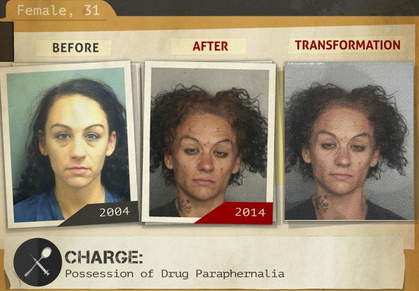 Φωτογραφίες σοκ: Καρέ-καρέ πώς αλλοιώνονται τα προσώπα των ναρκομανών -Ανθρωποι πριν και μετά τη χρήση [gif] | iefimerida.gr 25