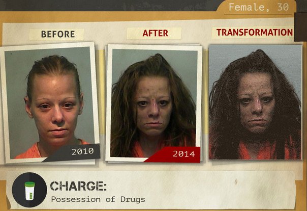 Φωτογραφίες σοκ: Καρέ-καρέ πώς αλλοιώνονται τα προσώπα των ναρκομανών -Ανθρωποι πριν και μετά τη χρήση [gif] | iefimerida.gr 3