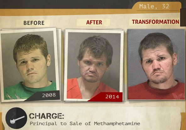 Φωτογραφίες σοκ: Καρέ-καρέ πώς αλλοιώνονται τα προσώπα των ναρκομανών -Ανθρωποι πριν και μετά τη χρήση [gif] | iefimerida.gr 7