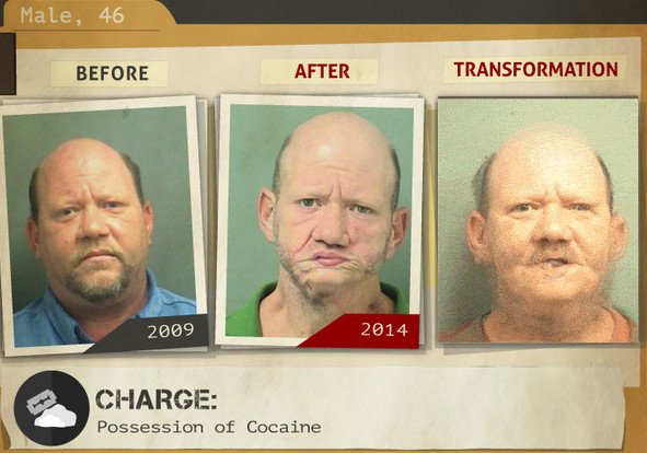 Φωτογραφίες σοκ: Καρέ-καρέ πώς αλλοιώνονται τα προσώπα των ναρκομανών -Ανθρωποι πριν και μετά τη χρήση [gif] | iefimerida.gr 9