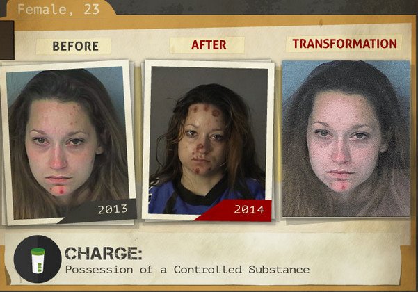 Φωτογραφίες σοκ: Καρέ-καρέ πώς αλλοιώνονται τα προσώπα των ναρκομανών -Ανθρωποι πριν και μετά τη χρήση [gif] | iefimerida.gr 13