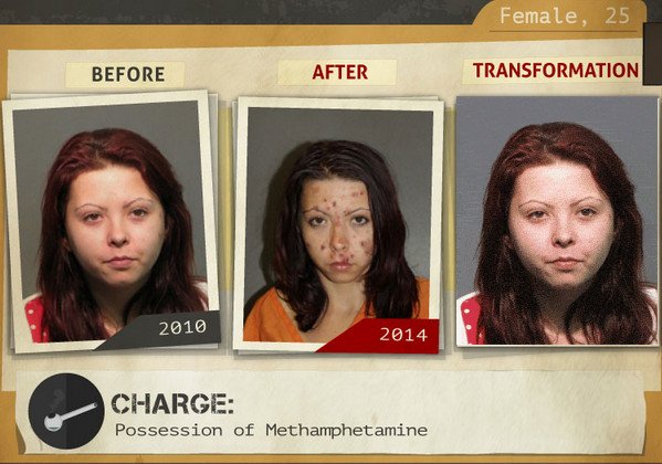 Φωτογραφίες σοκ: Καρέ-καρέ πώς αλλοιώνονται τα προσώπα των ναρκομανών -Ανθρωποι πριν και μετά τη χρήση [gif] | iefimerida.gr 15