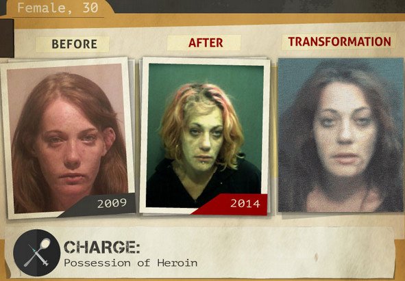Φωτογραφίες σοκ: Καρέ-καρέ πώς αλλοιώνονται τα προσώπα των ναρκομανών -Ανθρωποι πριν και μετά τη χρήση [gif] | iefimerida.gr 17