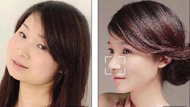 «Δυτικό πρόσωπο» -Η πλαστική που κάνει θραύση [εικόνες] | iefimerida.gr 0