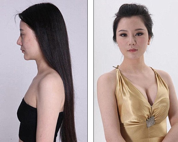 «Δυτικό πρόσωπο» -Η πλαστική που κάνει θραύση [εικόνες] | iefimerida.gr 9