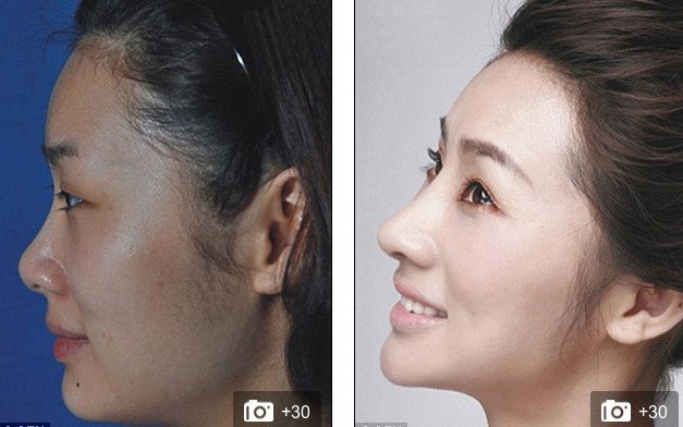 «Δυτικό πρόσωπο» -Η πλαστική που κάνει θραύση [εικόνες] | iefimerida.gr 10