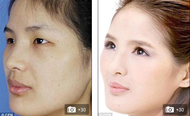 «Δυτικό πρόσωπο» -Η πλαστική που κάνει θραύση [εικόνες] | iefimerida.gr 11