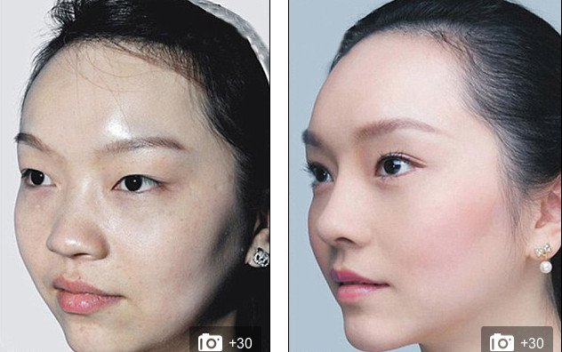 «Δυτικό πρόσωπο» -Η πλαστική που κάνει θραύση [εικόνες] | iefimerida.gr 13