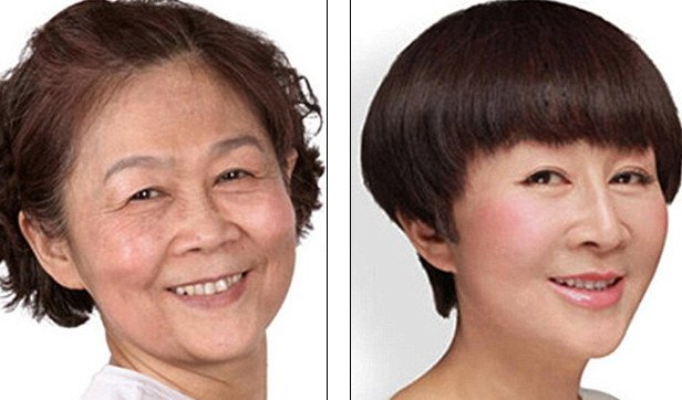 «Δυτικό πρόσωπο» -Η πλαστική που κάνει θραύση [εικόνες] | iefimerida.gr 14