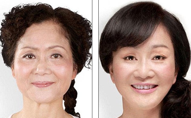 «Δυτικό πρόσωπο» -Η πλαστική που κάνει θραύση [εικόνες] | iefimerida.gr 15