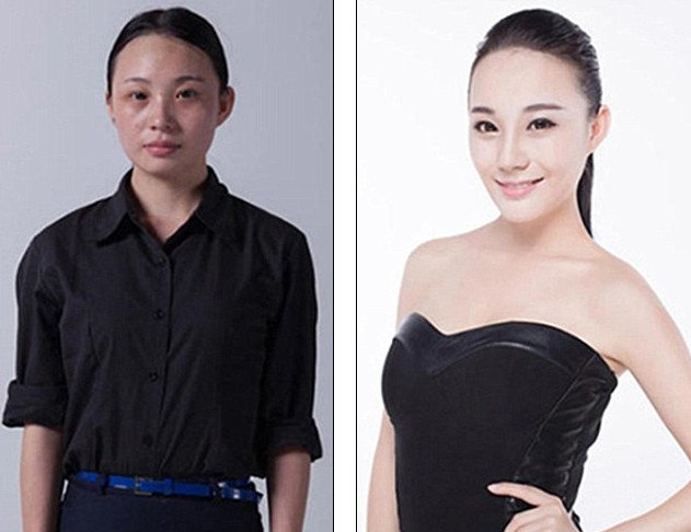 «Δυτικό πρόσωπο» -Η πλαστική που κάνει θραύση [εικόνες] | iefimerida.gr 2