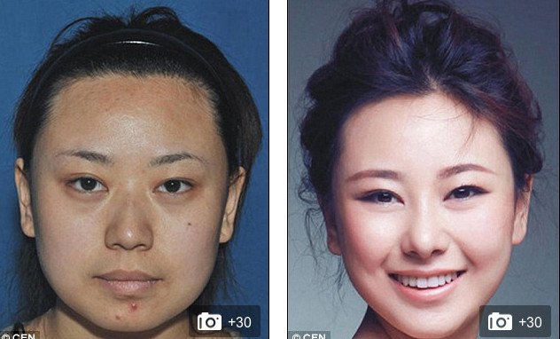 «Δυτικό πρόσωπο» -Η πλαστική που κάνει θραύση [εικόνες] | iefimerida.gr 3