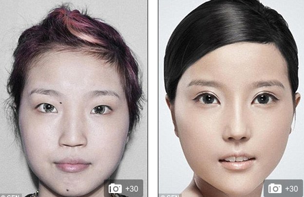 «Δυτικό πρόσωπο» -Η πλαστική που κάνει θραύση [εικόνες] | iefimerida.gr 4