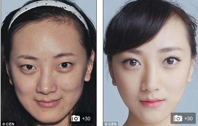 «Δυτικό πρόσωπο» -Η πλαστική που κάνει θραύση [εικόνες] | iefimerida.gr 5