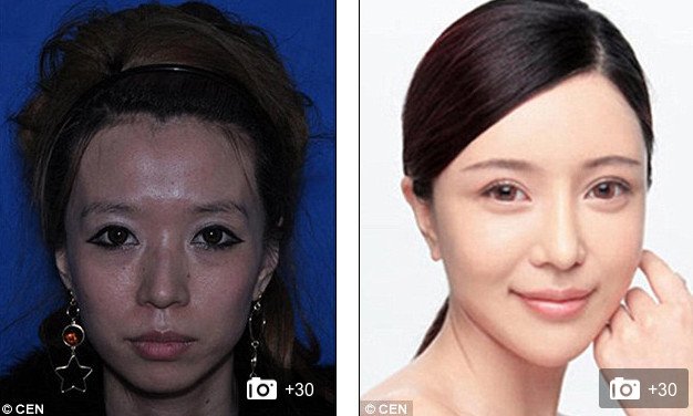 «Δυτικό πρόσωπο» -Η πλαστική που κάνει θραύση [εικόνες] | iefimerida.gr 6