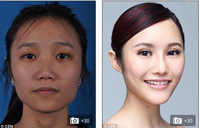 «Δυτικό πρόσωπο» -Η πλαστική που κάνει θραύση [εικόνες] | iefimerida.gr 7