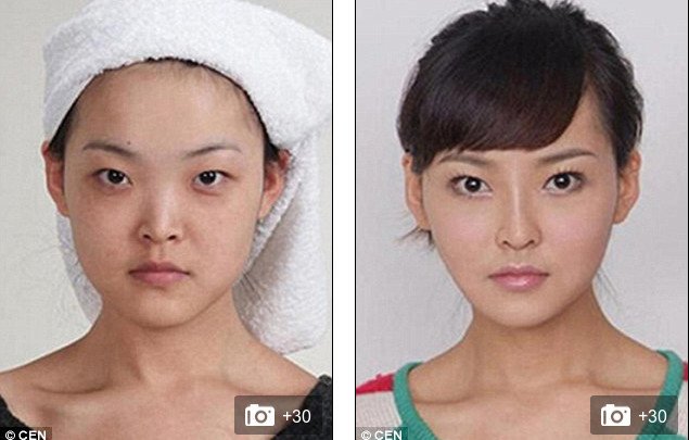 «Δυτικό πρόσωπο» -Η πλαστική που κάνει θραύση [εικόνες] | iefimerida.gr 8