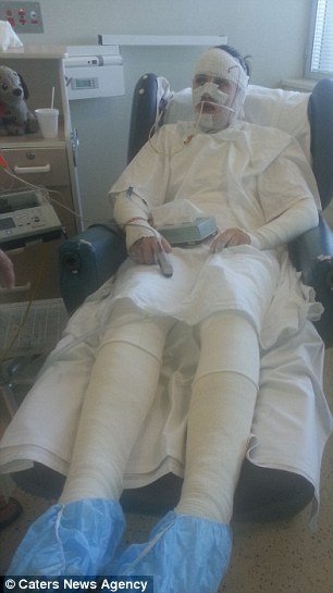 Kάηκε το δέρμα της από μέσα προς τα έξω από λάθος φάρμακο -Συγκλονίζει η 19χρονη καλλονή [εικόνες] | iefimerida.gr 2