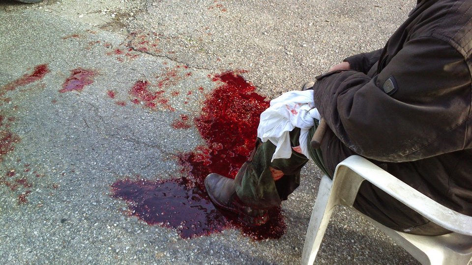 Αγρια επίθεση αγέλης σκύλων κατά ηλικιωμένου [εικόνες & βίντεο] | iefimerida.gr 2