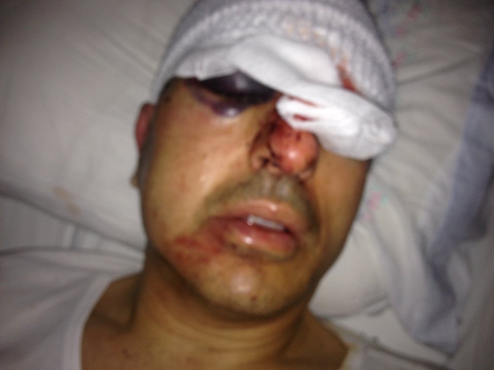 Φωτογραφία-σοκ -Το αλλοιωμένο πρόσωπο του αντιδημάρχου Ηρακλείου μετά τη δολοφονική επίθεση που δέχθηκε [εικόνα] | iefimerida.gr 0