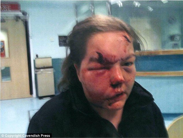 Η φρίκη των ναρκωτικών -Η παραμόρφωση νεαρής από χρήση ουσίας, που σόκαρε [εικόνες] | iefimerida.gr 1